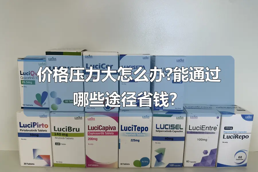 价格压力大怎么办?能通过哪些途径省钱？